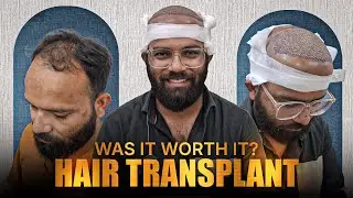Hair transplant in bhopal | Best Results & Cost of Hair transplant in bhopal
