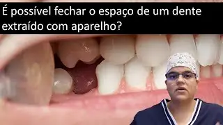 É possível fechar com aparelho o espaço de um dente extraído?| Dra Bianca Rosa | Clínica Bianca Rosa