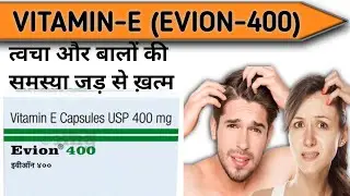 Evion 400 Capsule | Uses | Benefits | side effects | #mbbs #pharmcist #pharmacy 