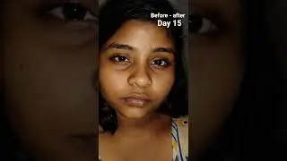 dermaco snail peptide 96 under eye repair cream/ day 15
