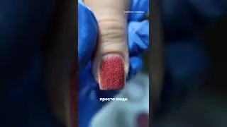 Титановые ногти это/ титановые ногти отзывы / аллергия на гель-лак