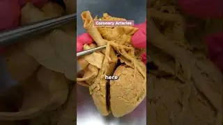 Heart Attack: This is the Cause