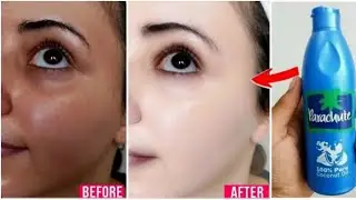 Super Skin Brighteing   After 1 Use Visible Spotless Glowing Skin  Removed Dark Spots