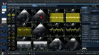 4939 GME , SMALL ANIMAL ECHOCARDIOGRAPHY , MTYOCARDIAL WORK INDEX,TRANSCRANIAL DOPPLER ,C6-T2 PATHY
