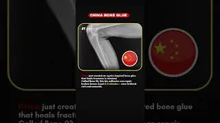 China&rsquo;s Oyster-Inspired Glue Heals Bones in Minutes. #factshorts #shortsfeed #didyouknow #chinafacts