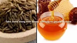Natural remedies for bladder stone removal