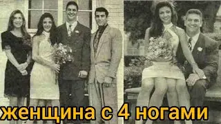 Джозефина Миртл Корбин, женщина с 4 ногами