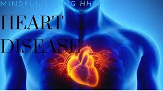 Heart Disease Prevention (reduce your risk)