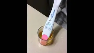 Positive pregnancy test.