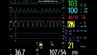 Permissive Hypercapnia in an Obese Senior Dog: Anesthesia Case During Laparoscopic Surgery
