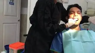 Impresiones con alginato y vaciado en yeso tipo III