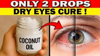 Only 2 Drops Of Coconut Oil For Dry Eyes