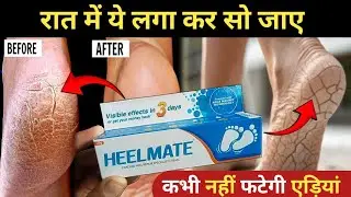 Heelmate Cracked Heel Repair Specialists Cream l Heelmate Cream Uses in hindi