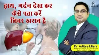 हाथ और गर्दन को देखकर जानें लिवर का हाल #liverdisease