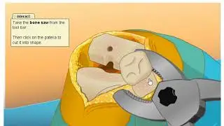Virtual Knee Surgery