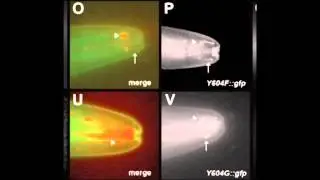 Role for Calcium in Pain Signaling