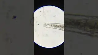 Artemia salina - microscopic detail of bowel movement.