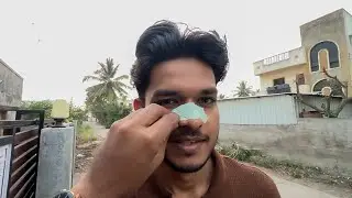 Ye Meri Naak Ko Kya Ho Gaya..?😭