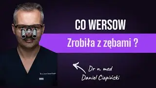 Co Wersow zrobiła z zębami?