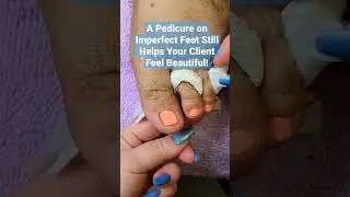 Pedicure After Foot Surgery #nailtechlife #pedicure #footsurgery #shorts #opi #naileducation