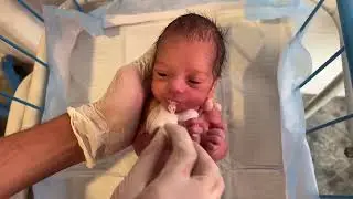 Cute Little Preterm Baby Feeding | Gentle NICU Feeding Time 👶🍼