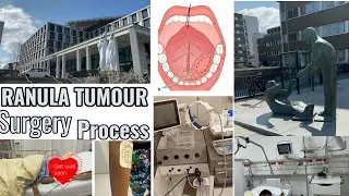 ENT RANULA TUMOUR IN THE MOUTH SURGERY FULL DETAILS.