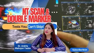 NT Scan & Double Marker Test in Pregnancy | Importance, Procedure & Full Details Explained!
