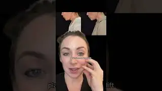 PSA: good surgical results should make it look like you never had surgery