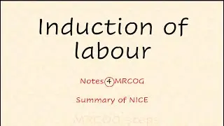 Induction of labour - notes 4 MRCOG