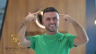 Final Result Of The Hair Transplant After 7 Months!