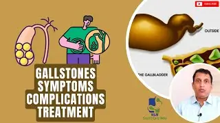 Gallstones | Symptoms, Complications, And Treatment | M&M Gastro Care India