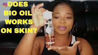 Bio Oil Review #Estaliaawoyaa #skincarereview
