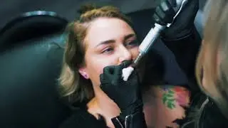 Needle free lip injections using the hyaluron pen!