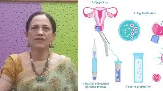 Assisted Reproductive Technology procedures in Hindi