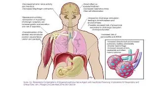 Respiratory desease caused by Aerotoxic Syndrome.