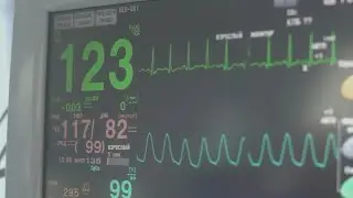 Cold weather could increase your chances of having a heart attack&mdash;here&rsquo;s why