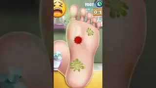 Foot injury operation surgery #collection #Viral #ASMR Body Videos
