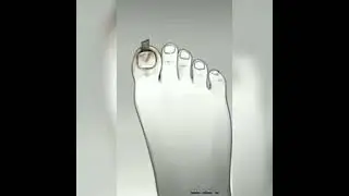 Aaaaaaaaaaa