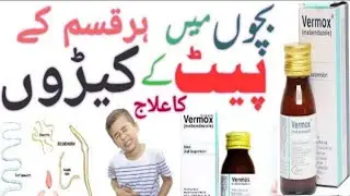 How to use Vermox syrup uses/Vermox tablet uses/Treatment of intestinal worms in children(Mr.medica)