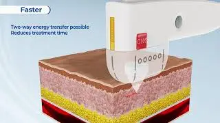 HIFU- New integral cartridge of UTIMS A3 R