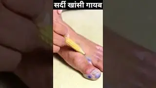 cold & cough relief reflexology point #apakahealthguru #shortsfeed #youtubeshorts #coldcough