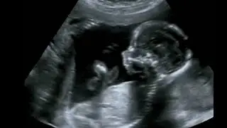 90% of abortions done in last decade in Ga. would be illegal now: Report