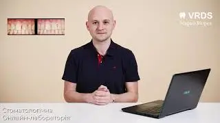 Як визначити колір в цифровій стоматології?  🔥 На основі РЕАЛЬНОГО КЕЙСУ 🔥