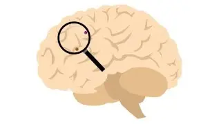 High Resolution Mapping of Protein Localization in Mammalian Brain