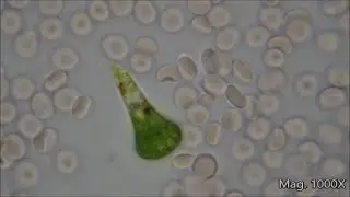 Comparing Microorganism Size Under the Microscope