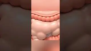 Gas & Bloating: What&rsquo;s Happening Inside Your Gut