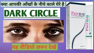 FAIR EYE for Dark circle || Use, Doses, side effect, benifits,||OPTOMETRY SOLUTION ||