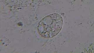 Discus disease - Unknown parasite in discus poop