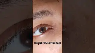 Pupil Constricted light response 😲😲😲 #mbbs  #trending #ytshorts