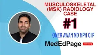 Musculoskeletal (MSK) Radiology Case #1